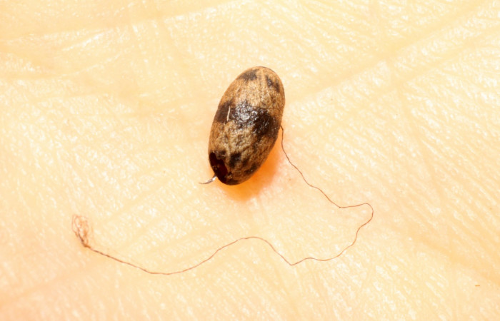 Figura. 11 Párasito Charops GauldADHJ04 (Ichneumonidae) de <i>Phuphena multilinea</i></i> (Noctuidae), Sector Pitilla, Estación Pitilla (elevación 675 metros). 11 Junio 2009. (09-SRNP-31814-DHJ474051.jpg).