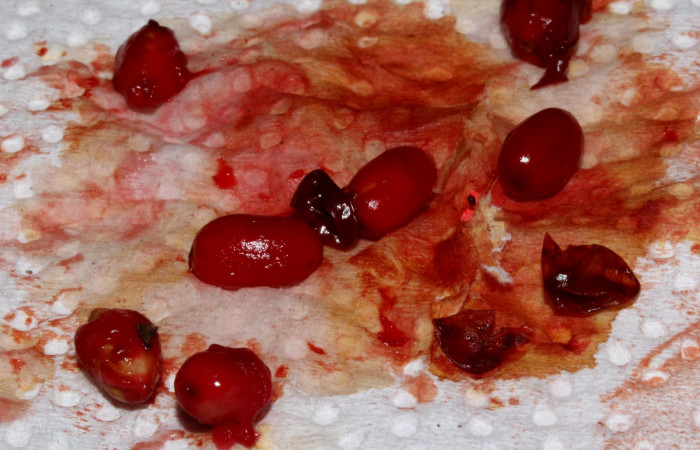 Fig.11  Semillas y arilo de frutos <i>Erythroxylum macrophyllum</i></i>, Estación Pitilla, Area de Conservación Guanacaste, Noviembre 2019.