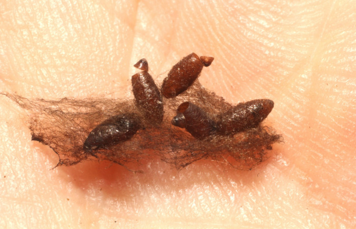 Figura 12. Capullos de <i>Meteorus</i></i> Janzen24 (Braconidae). Voucher: 13-SRNP-4069-DHJ804671.jpg.