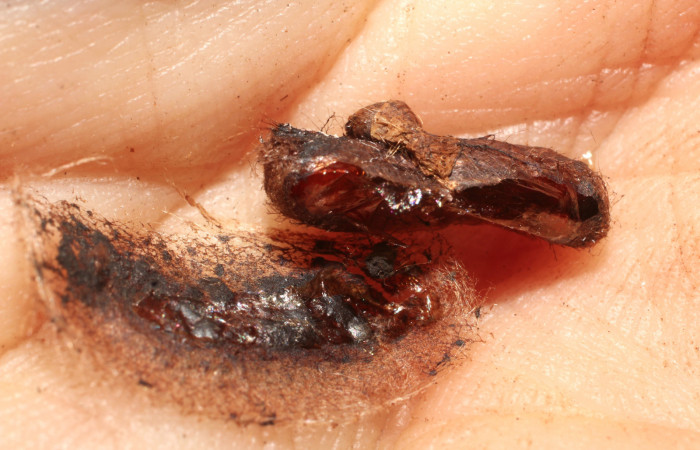 Fig.16 Prepupa Braconidae, <i>Heteropteron</i></i> Whitfield01 <i>Carthara</i></i> abruptaDHJ02. Voucher: 10-SRNP-56747-DHJ800270.jpg.